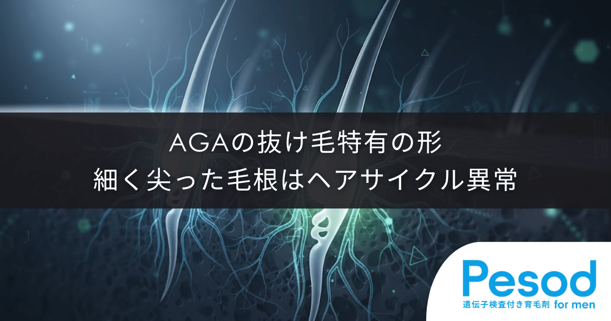 AGAの抜け毛に見られる特有の形｜細く尖った毛根はヘアサイクル異常の証拠