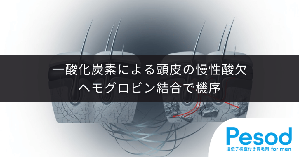 一酸化炭素による頭皮の慢性酸欠｜ヘモグロビン結合で酸素が届かず毛根が窒息する機序