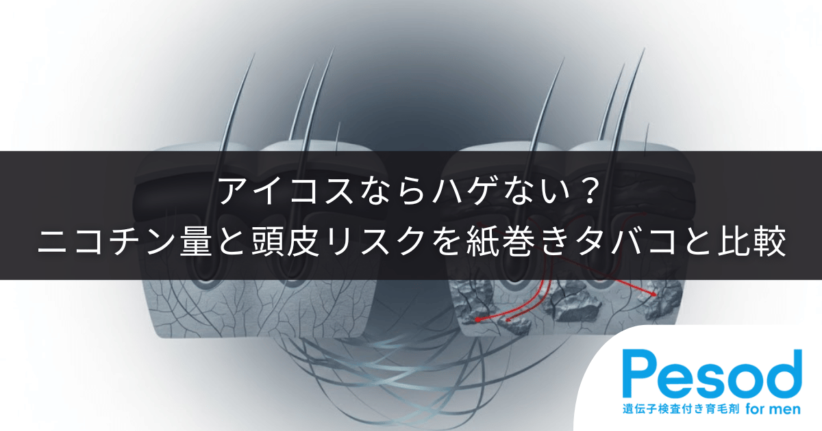 アイコス（加熱式タバコ）ならハゲない？紙巻きタバコと比較したニコチン量と頭皮リスク