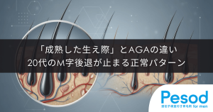 「成熟した生え際」とAGAの違い｜20代のM字後退が止まる正常なパターン