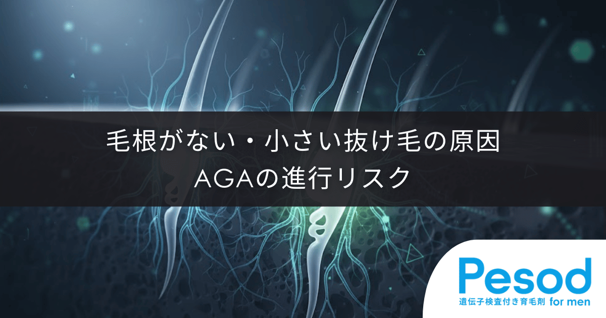 毛根がない・小さい抜け毛の原因｜委縮した毛球が示すAGAの進行リスク