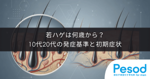 若ハゲは何歳から？10代20代の発症基準と絶対見逃せない初期症状