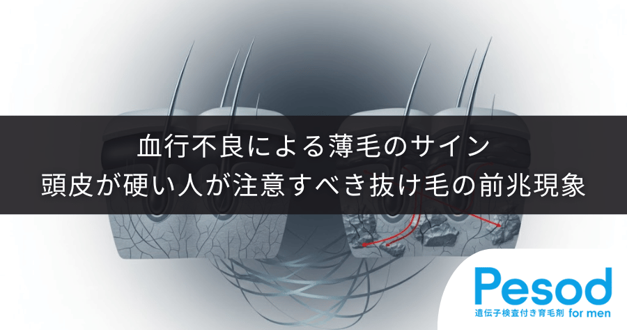 血行不良による薄毛のサイン｜頭皮が硬い人が注意すべき抜け毛の前兆現象