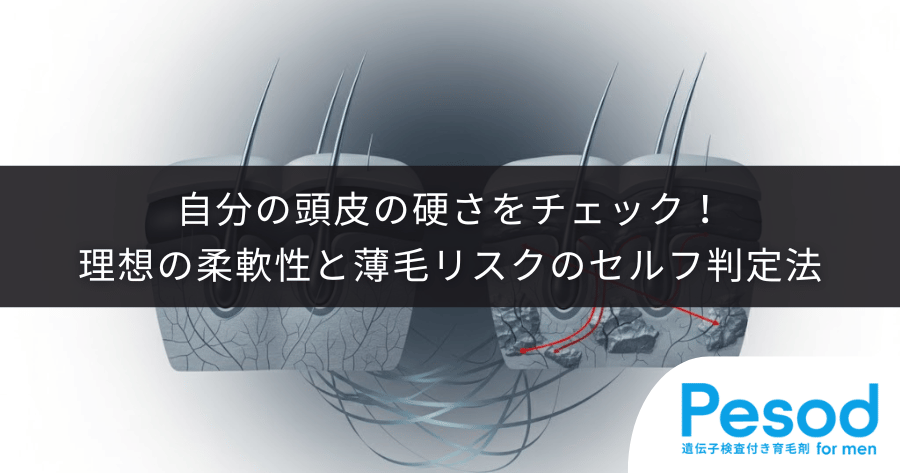 自分の頭皮の硬さをチェック！理想の柔軟性と薄毛リスクのセルフ判定法