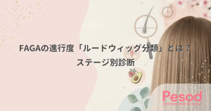 FAGAの進行度「ルードウィッグ分類」とは？分け目の広がりで見るステージ別診断
