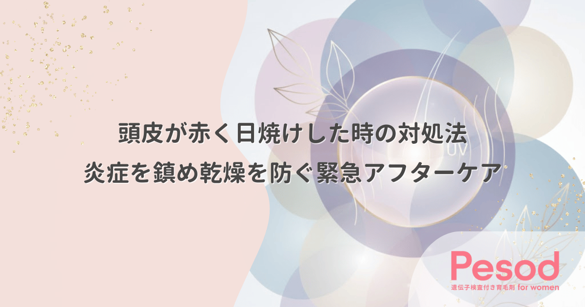 頭皮が日焼けして赤い時の対処法｜炎症を鎮め乾燥を防ぐ緊急アフターケア